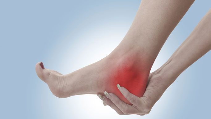 Fairfield Chiropractic Treatment for Plantar Fasciitis